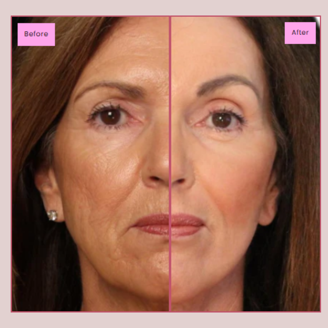 Collagen Night Wrapping Mask