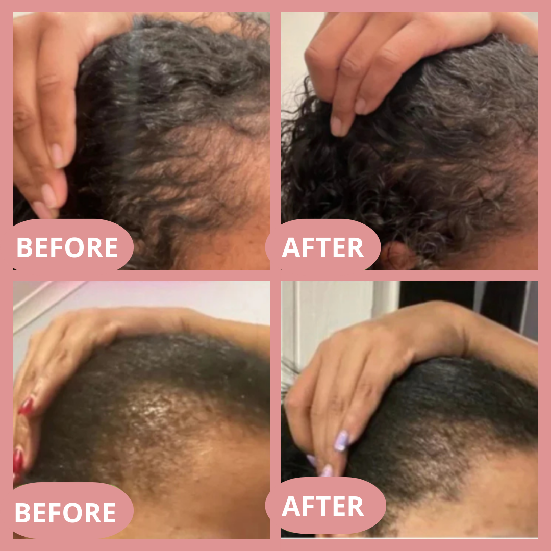Hair Strength Oil