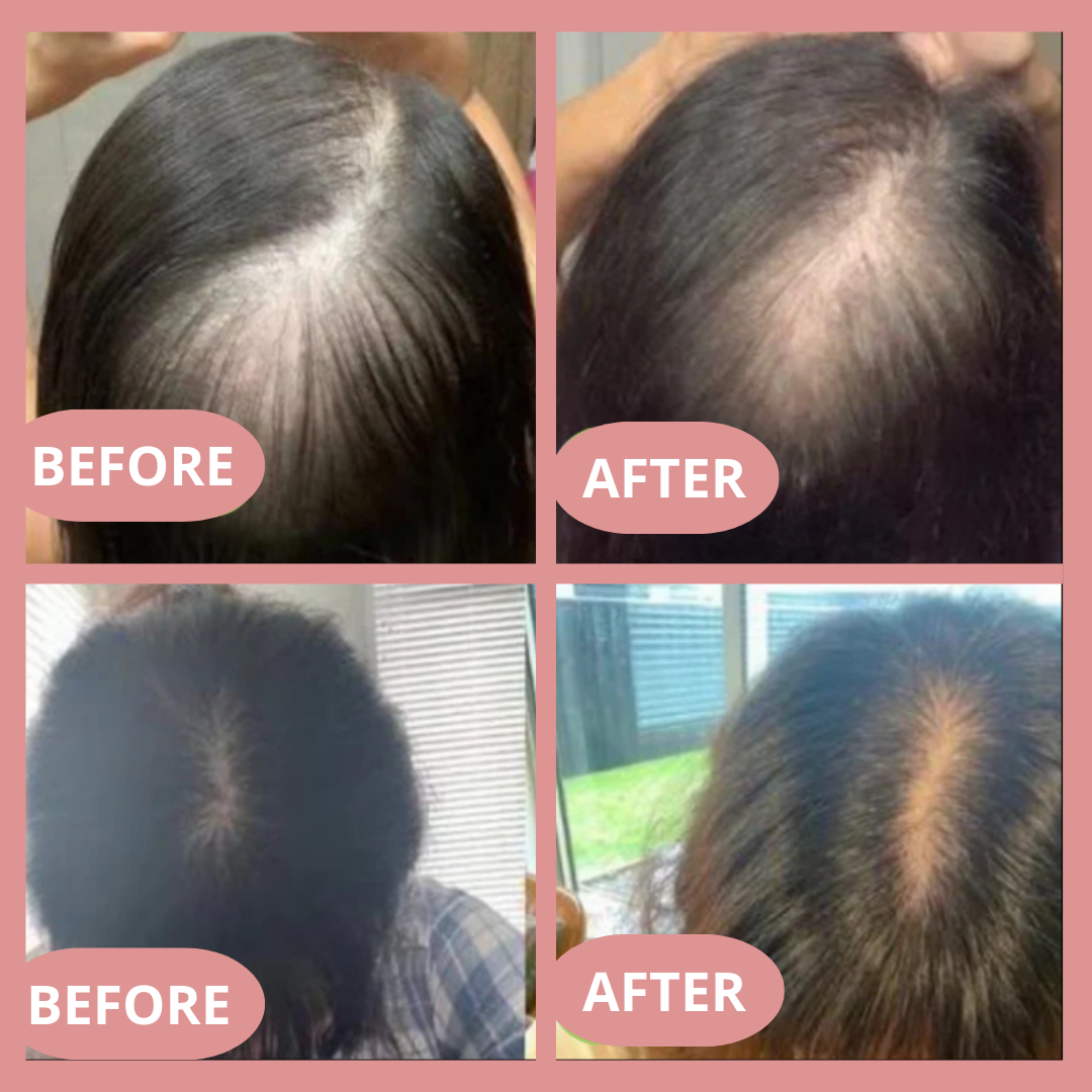 Hair Strength Oil