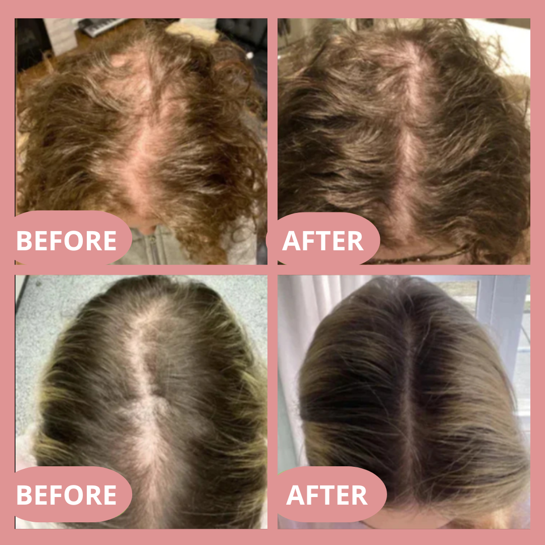 Hair Strength Oil