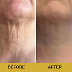 NeckLift Pro