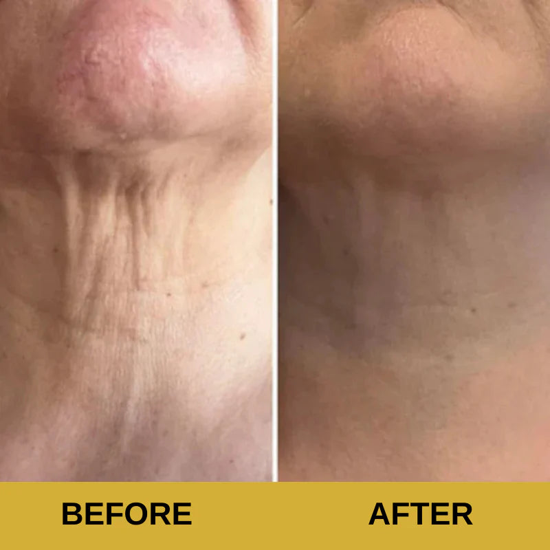 NeckLift Pro