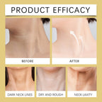 NeckLift Pro