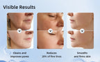 Ageless Skin Massager Device